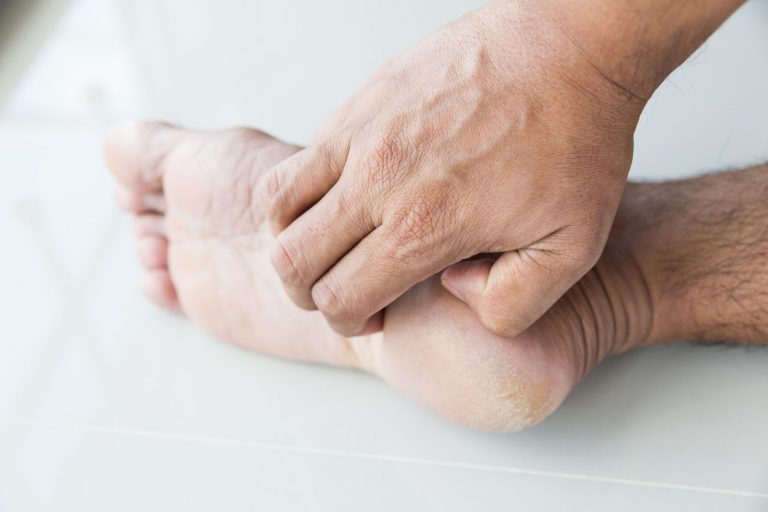 Fungal Infections