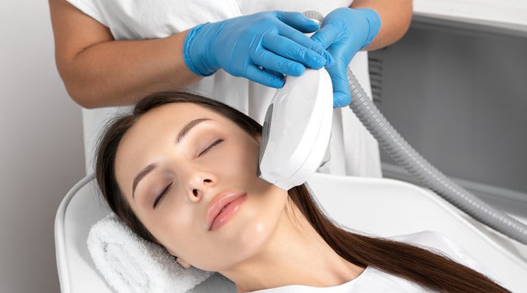 IPL PhotoFacial