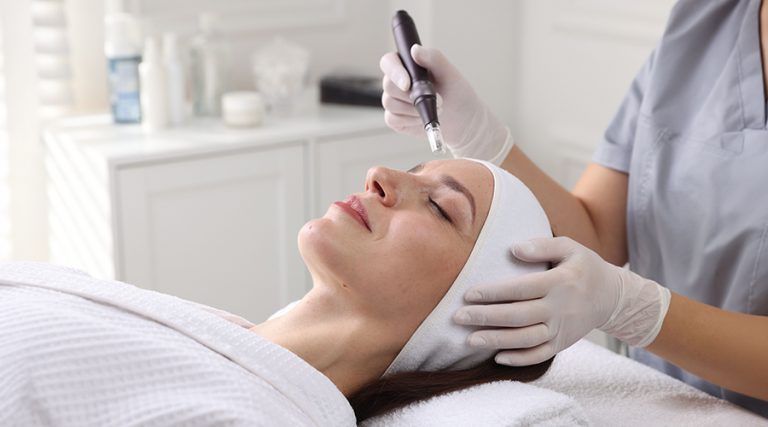 Microneedling