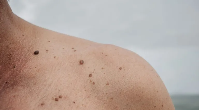 Moles