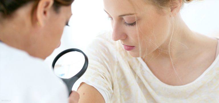 Everything You Need To Know About Melanoma Prevention & Diagnosis