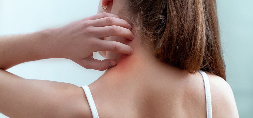 Woman with ponytail scratching eczema on her neck