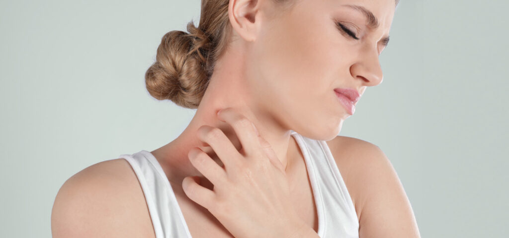 Woman scratching the eczema rash on her neck