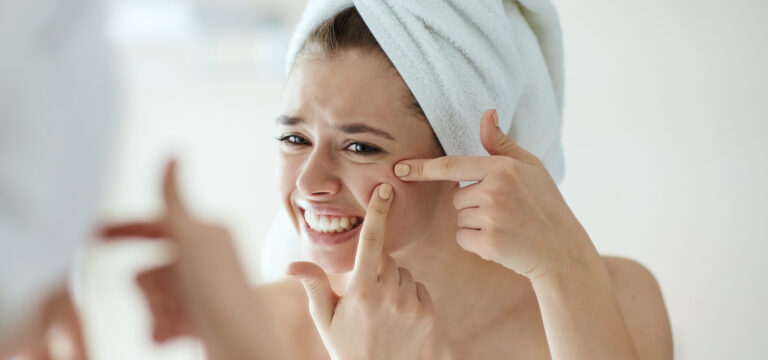 4 Ways to Treat Acne