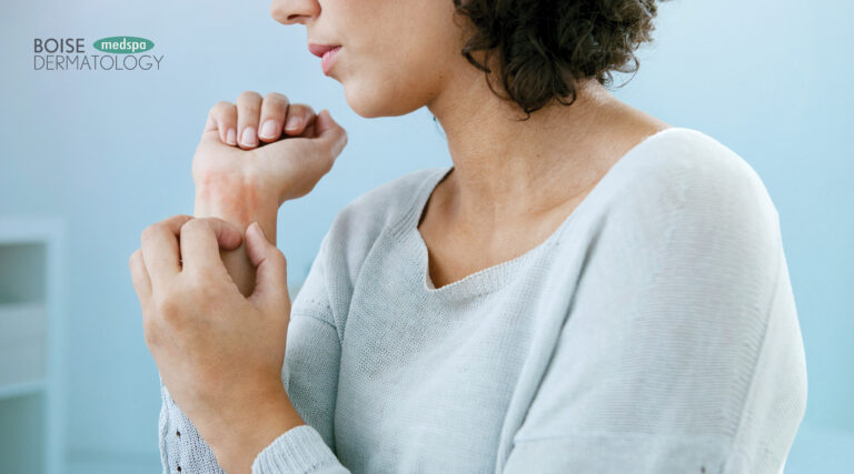 Psoriasis Treatment in the Treasure Valley: Managing Chronic Skin Conditions with Expert Dermatology Care